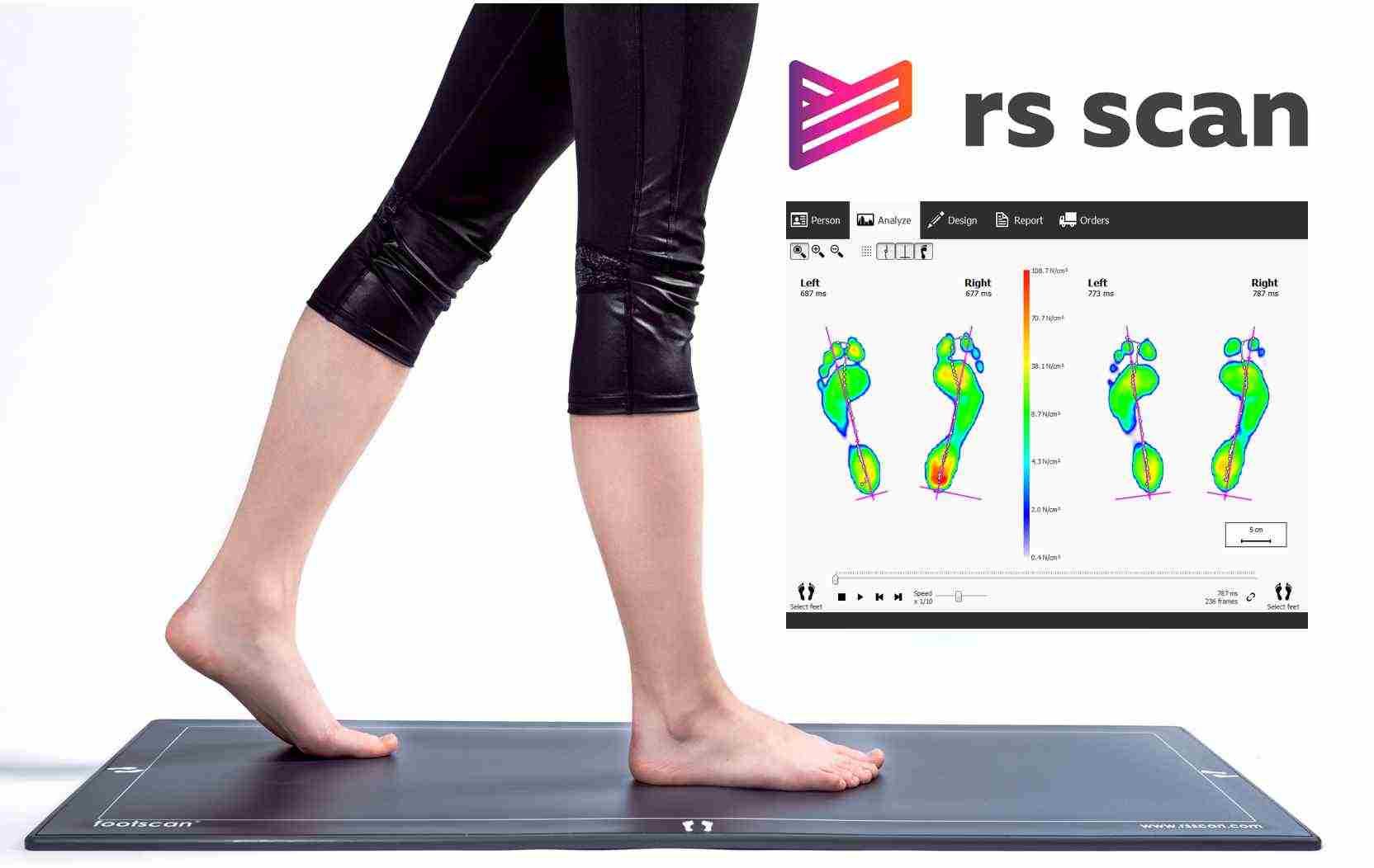 footscan analysis